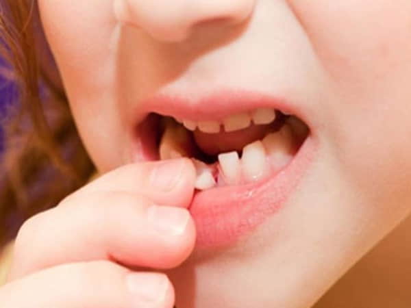 Con số lô tô của giấc chiêm bao thấy rụng răng