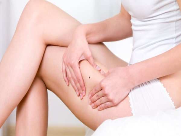Nốt ruồi ở đùi có ý nghĩa gì