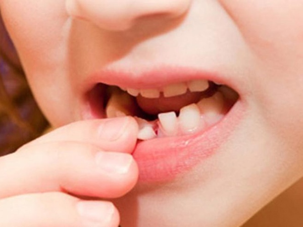 Mơ gãy răng đánh con gì lấy hên, báo mộng trước điềm gì?