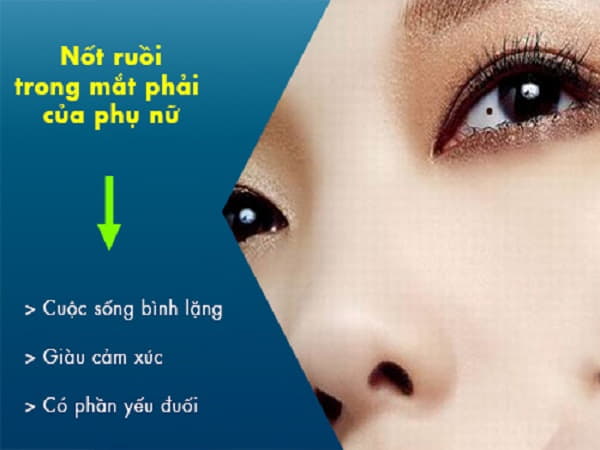 Bói nốt ruồi trong mắt phải