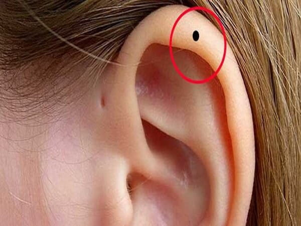 Xem bói nốt ruồi ở vành tai