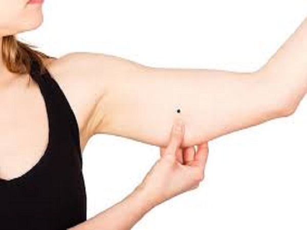 Ý nghĩa chung của nốt ruồi trên cánh tay