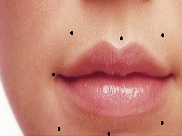 Ý nghĩa chung của nốt ruồi ở mép