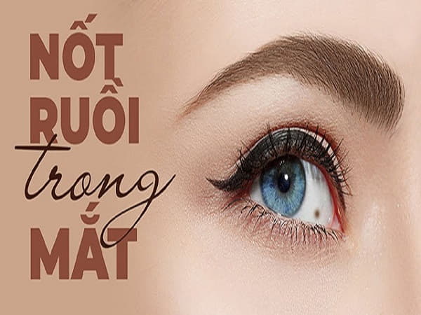 Ý nghĩa chung về nốt ruồi trong mắt