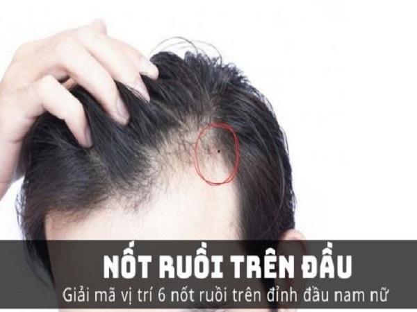 Ý nghĩa nốt ruồi trên đầu