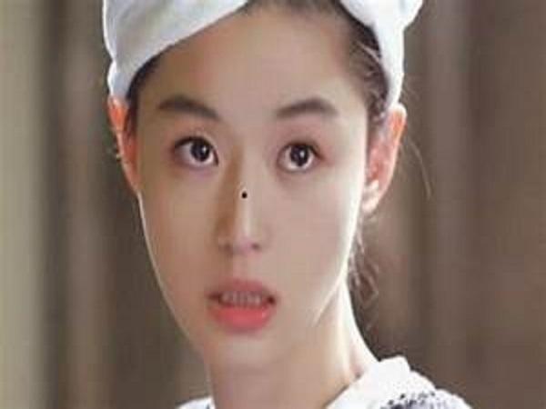 Mụn ruồi ở sống mũi nữ giới