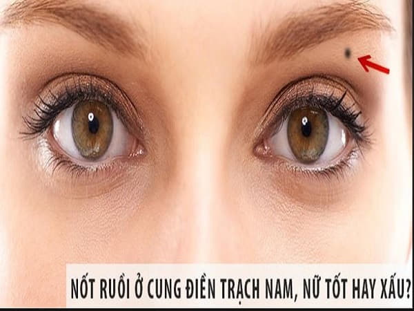 Nốt ruồi ở cung điền trạch tốt hay xấu?