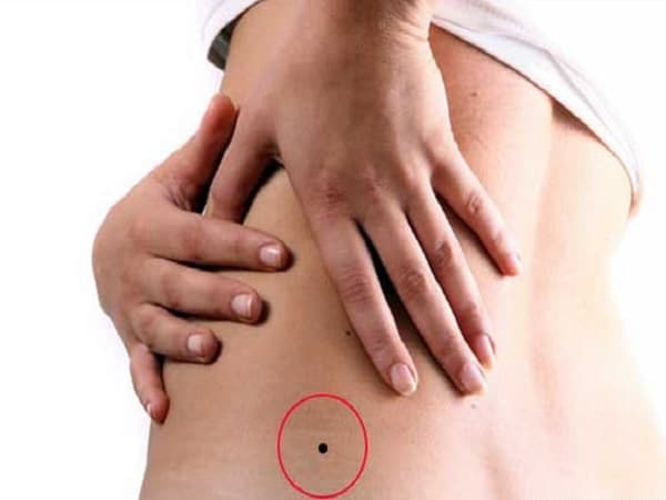 Ý nghĩa chung của mụn ruồi ở hông