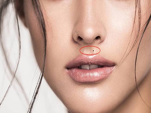 Ý nghĩa nốt ruồi ở nhân trung