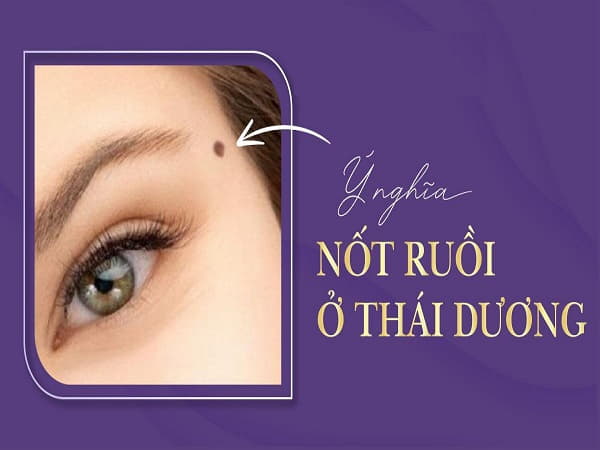Ý nghĩa của nốt ruồi ở Thái Dương