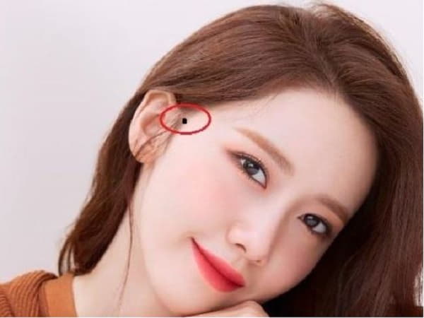 Chấm đen ở tóc mai của Nữ giới