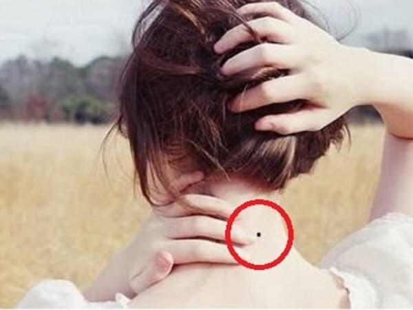Vậy, nốt ruồi sau gáy phụ nữ là hung hay cát