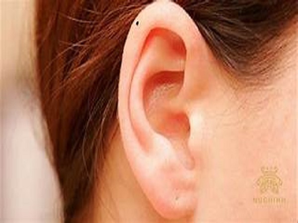 Ý nghĩa chung của nốt ruồi trên vành tai