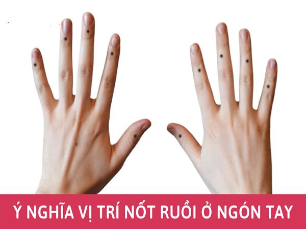 Ý nghĩa nốt ruồi ở từng ngón tay