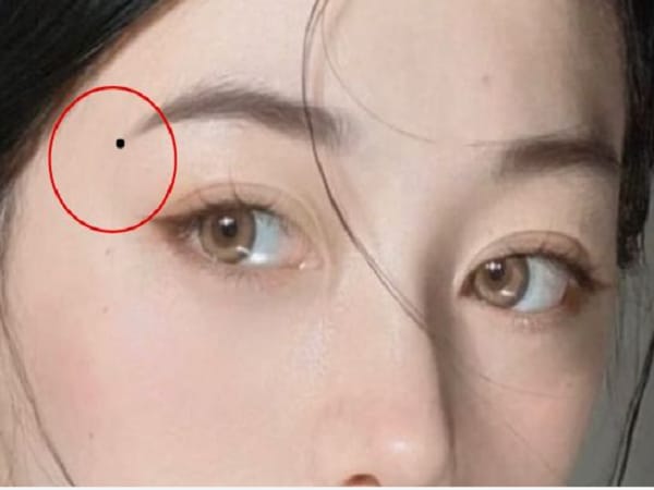 Chấm đen ở đuôi lông mày bên phải