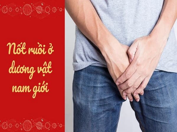 Ý nghĩa chấm đen ở dương vật đàn ông