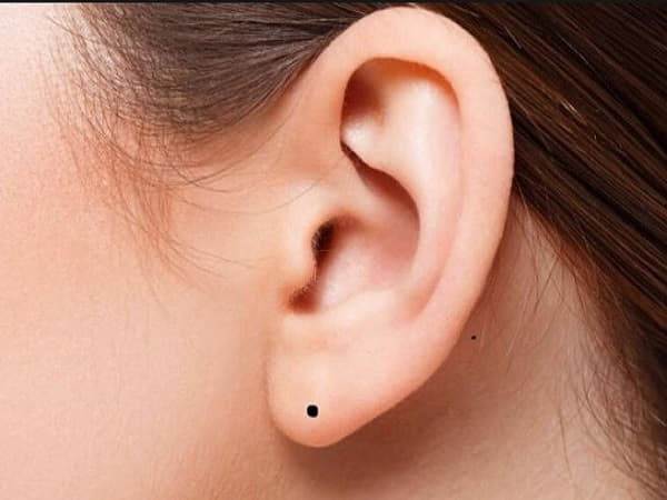 Ý nghĩa của nốt ruồi ở dái tai bên phải