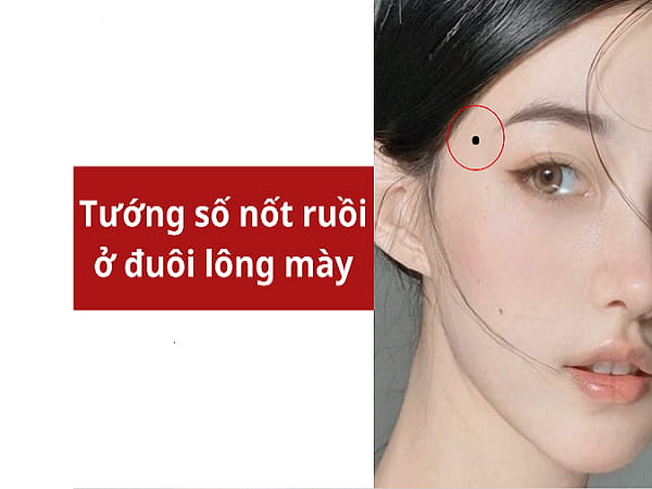 Ý nghĩa chung của mụn ruồi ở đuôi lông mày