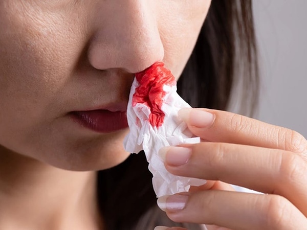 Lý giải điềm tốt xấu khi nằm mơ thấy bị chảy máu