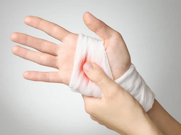 Lý giải điềm tốt xấu khi nằm mơ thấy bị chảy máu