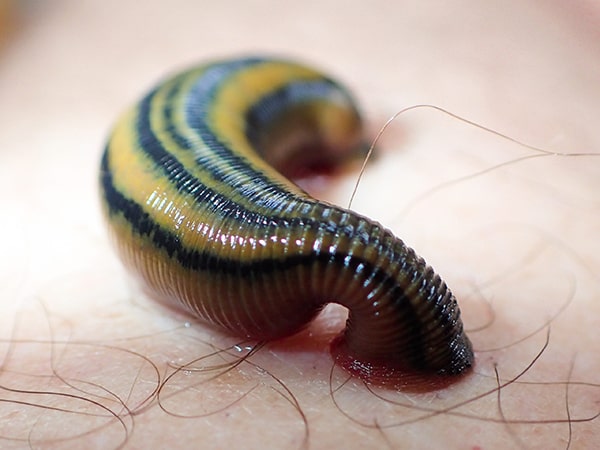 Nằm mê thấy đỉa cắn người thân